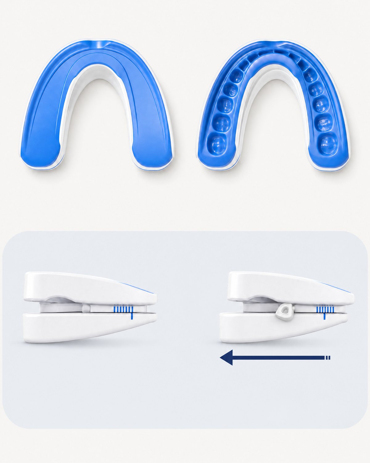 Two halves. Top: two views of the mouthguard from above, before and after fitting. Bottom: two side views of the closed device, at its neutral setting and adjusted forward, with the key in the side screw.